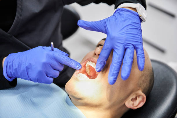 Best Dentist for Tooth Abscess  in California, MD
