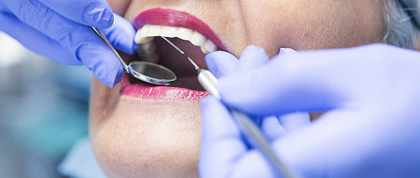 Best Emergency Tooth Extraction  in California, MD